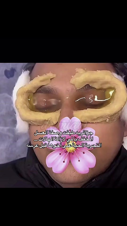 TikTok video thumbnail by .dr.miaw
