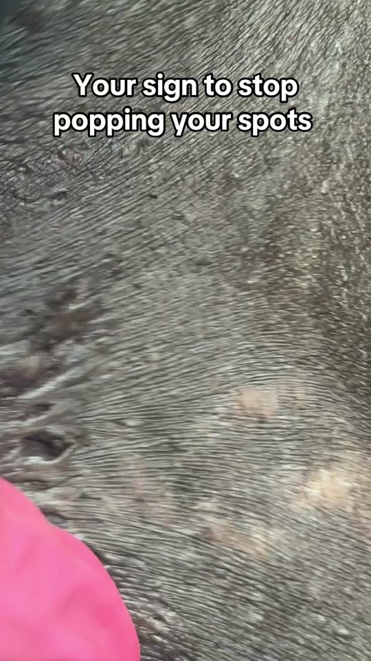 TikTok video thumbnail by galaxyextractions