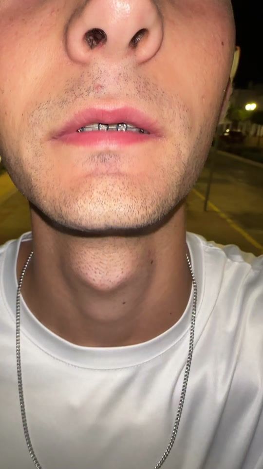 TikTok video thumbnail by tomas_asoaress