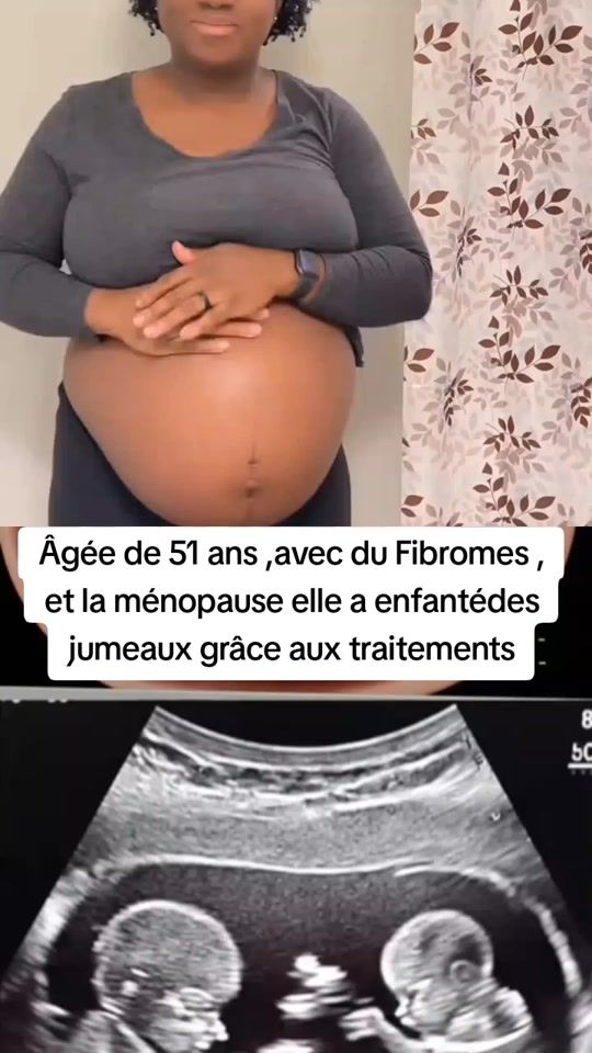 TikTok video thumbnail by dr_agougou