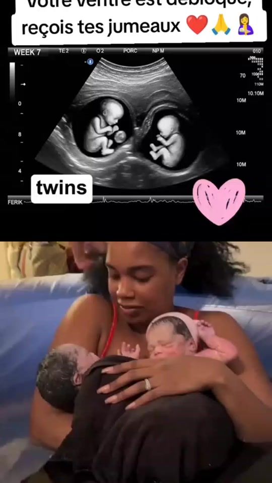 TikTok video thumbnail by dr_agougou