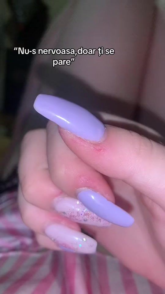 TikTok video thumbnail by petraa.5