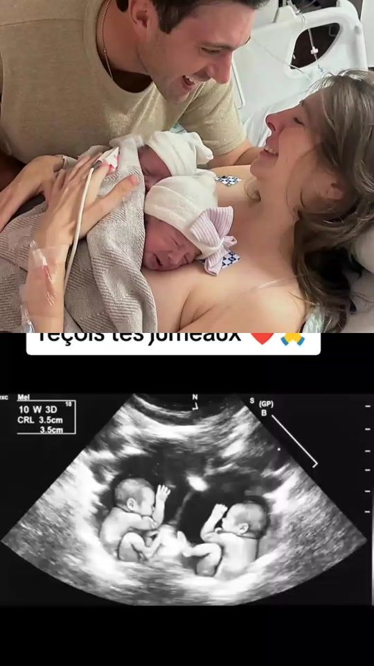 TikTok video thumbnail by dr_agougou