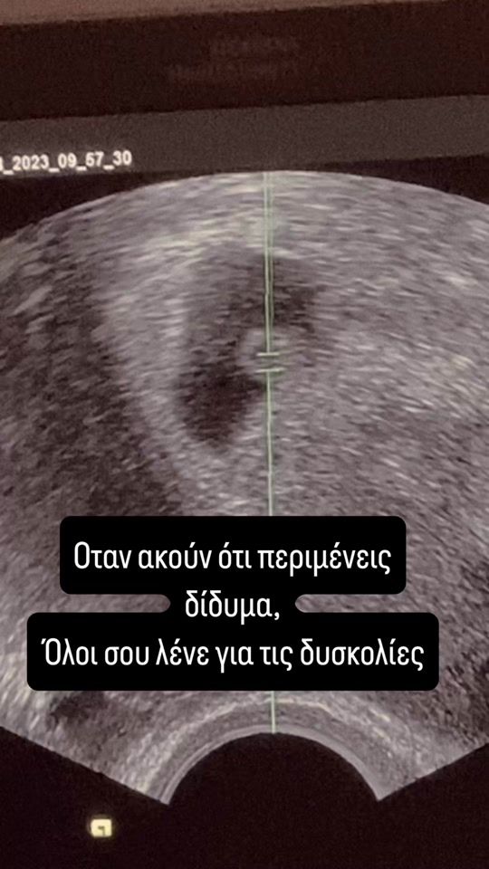 TikTok video thumbnail by doliamana