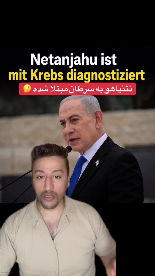 TikTok video thumbnail by omid.ehsas1