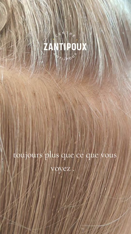 TikTok video thumbnail by zantipoux