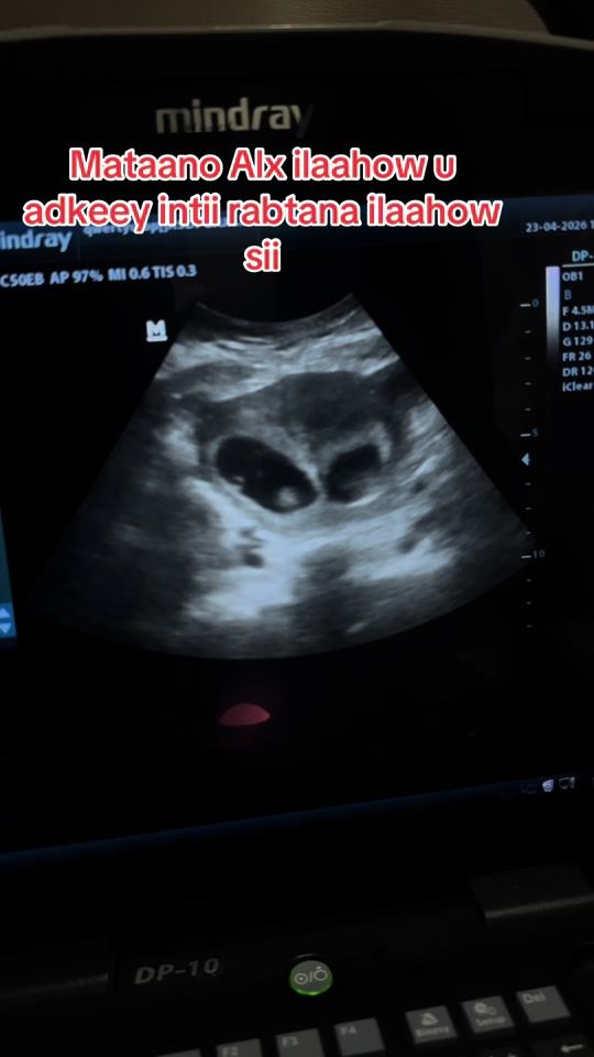 TikTok video thumbnail by drhafsamohamoud