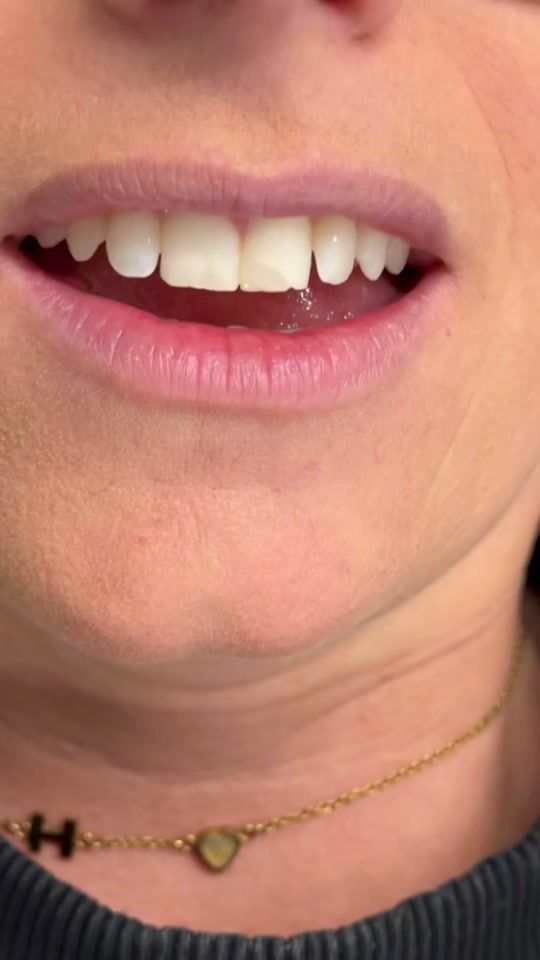 TikTok video thumbnail by maisondental