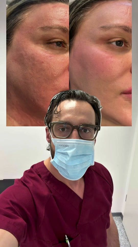 TikTok video thumbnail by s.thetisch